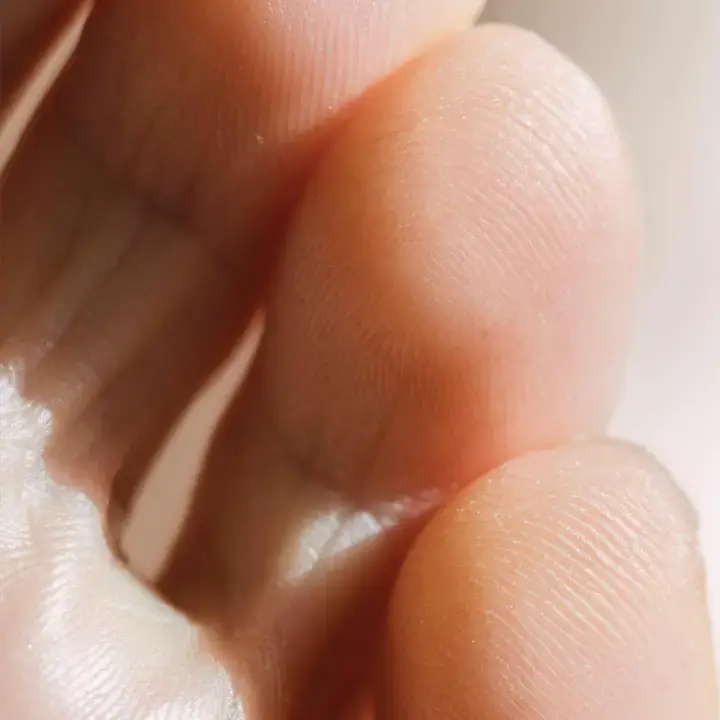 servicios-expressMEDIPEDI_EXPRESS_-_CALLOSIDADES (1).webp