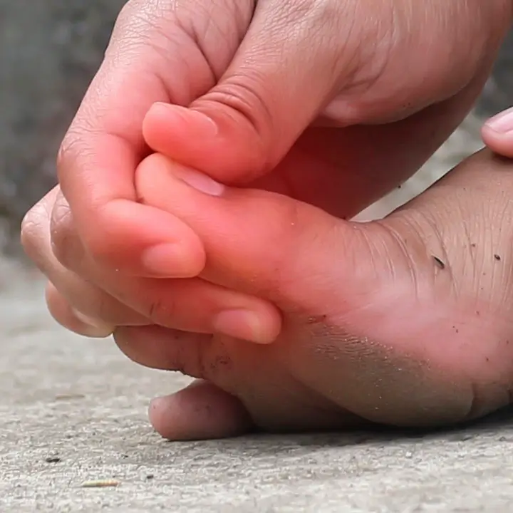 SERVICIO DE UÑERO INYECTABLE