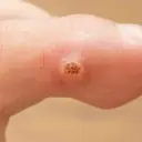 OJO DE PESCADO ADICIONAL  